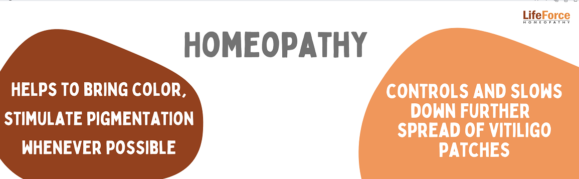 Homeopathy for vitiligo